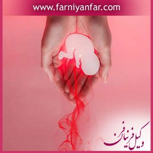 دیه سقط جنین و قوانین مربوطه
