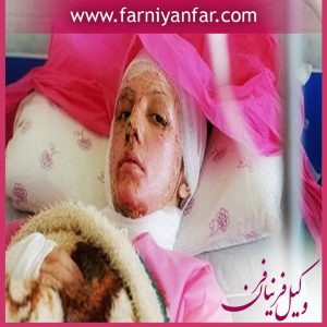 مجازات تهدید به اسید پاشی