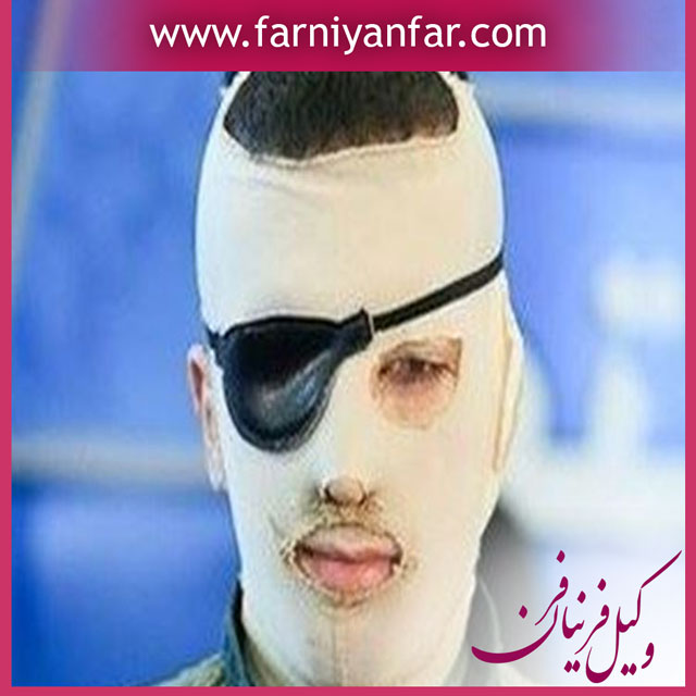 تهدید به اسید پاشی
